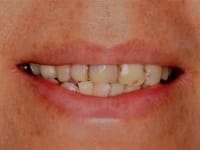 Konig Center for Cosmetic & Comprehensive Dentistry smile photos